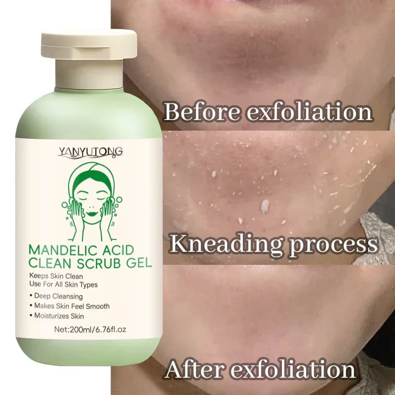 Gel exfoliant pour le visage, nettoyage en profondeur des pores, élimination des points noirs, exfoliation, contrôle du sébum, gommage hydratant, amélioration de la rugosité – photo 2