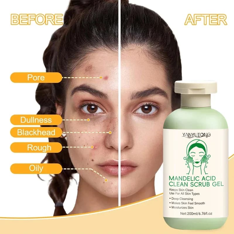 Gel exfoliant pour le visage, nettoyage en profondeur des pores, élimination des points noirs, exfoliation, contrôle du sébum, gommage hydratant, amélioration de la rugosité – photo 5